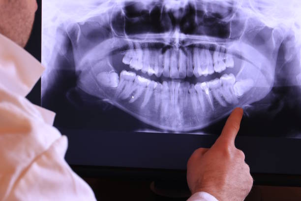 Best Emergency Gum Treatment in Harrisburg, IL